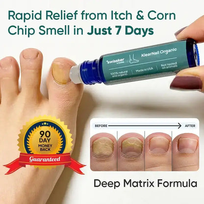KlearNail Organic Antifungal Treatment