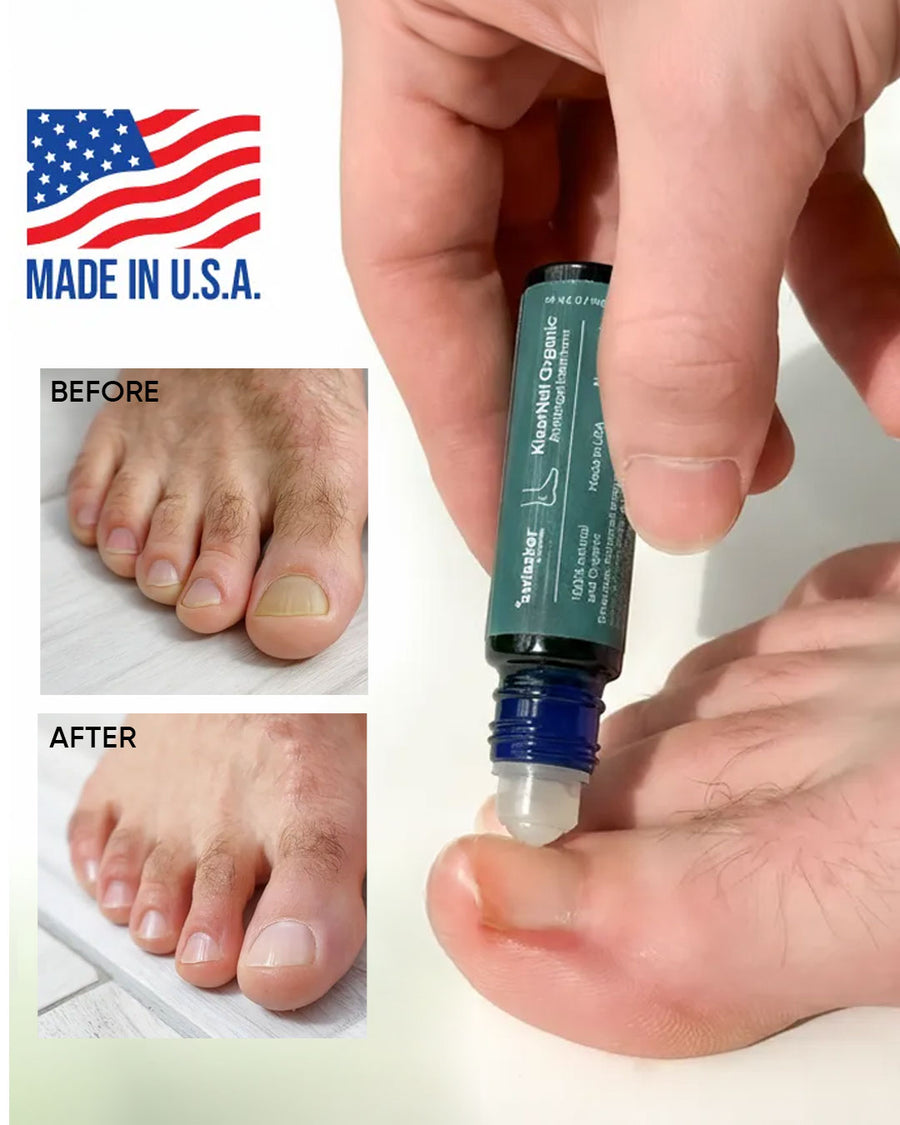 KlearNail Product and Results